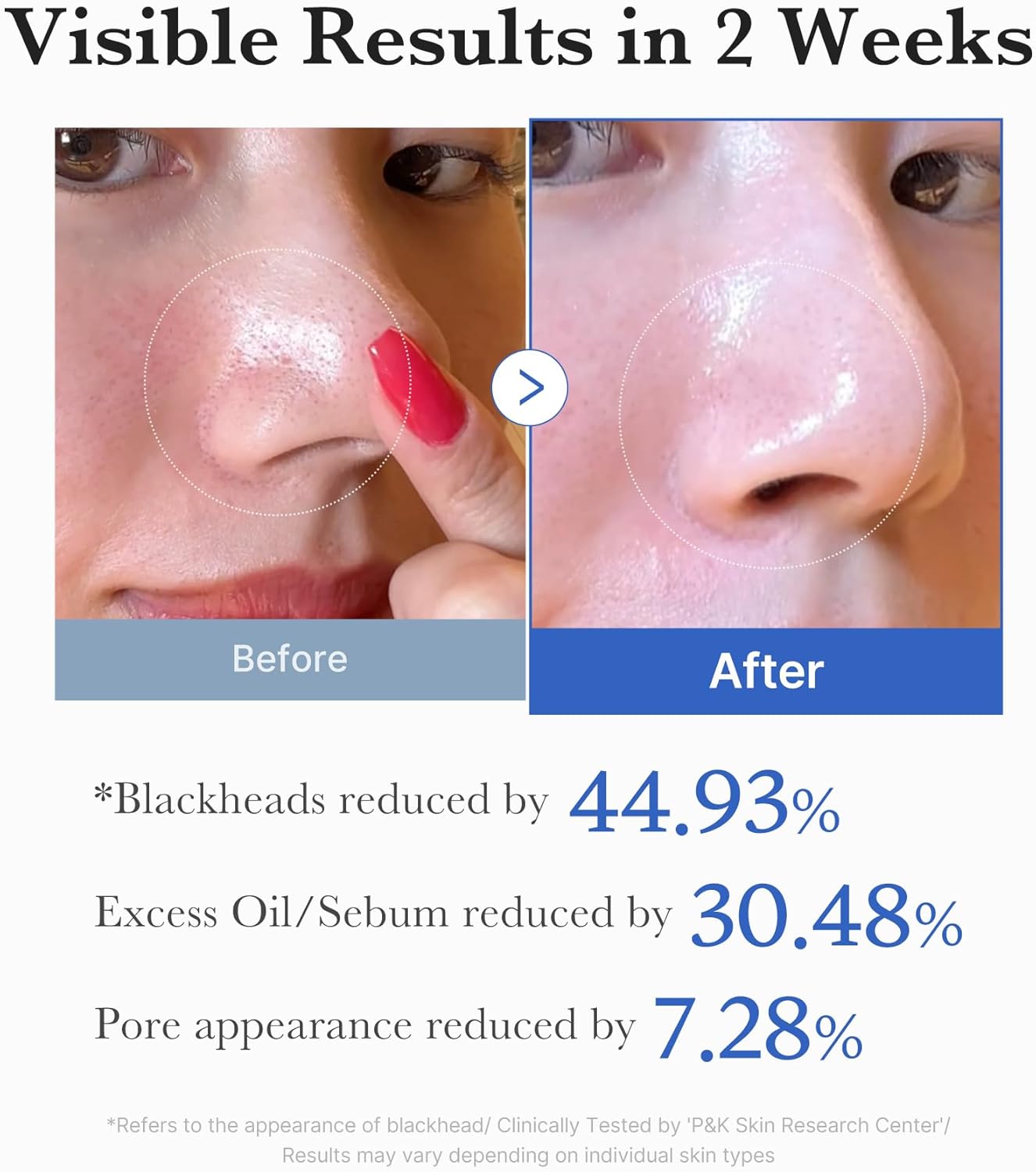 Zero Pore Pad 2.0 - Medicube